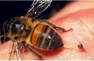 被蜜蜂蛰了怎么处理，先将蜜蜂刺取出/然后用肥皂清洗