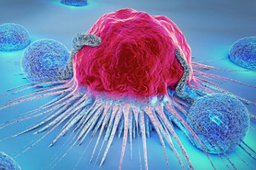 四种癌已经不是癌了，前列腺癌/甲状腺癌/子宫体癌/膀胱癌