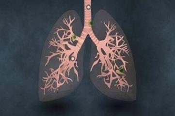 肺部感染最怕三个征兆，呼吸困难/胸痛/高烧不退